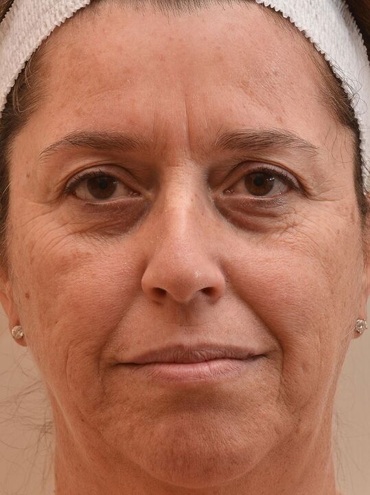 Então eu olhei antes de usar o creme Eudalie