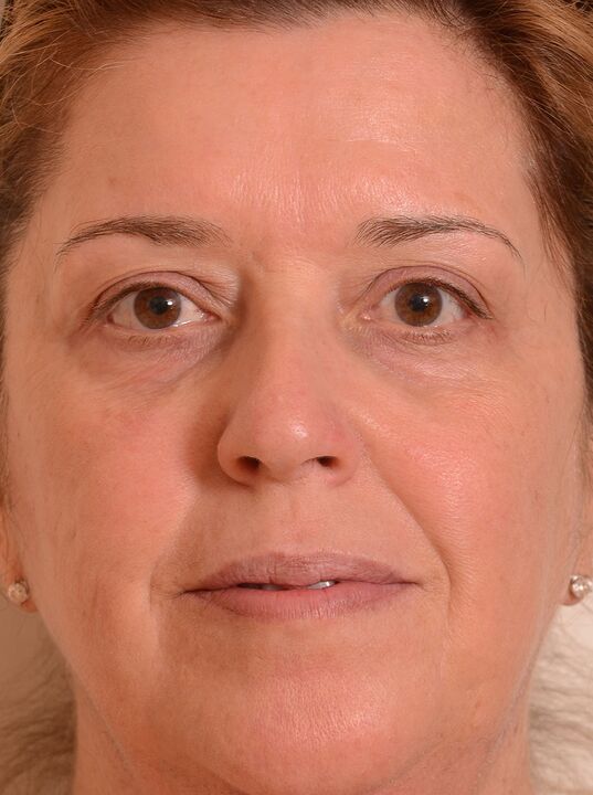 Eu rejuvenesci meu rosto com creme Eudalie