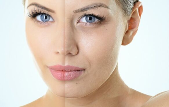 Indicações para rejuvenescimento fracionário