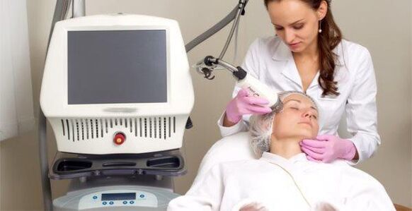 Realizando o procedimento