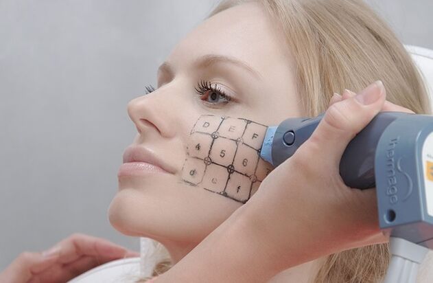 Procedimento térmico